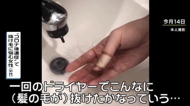 ハリウッド女優も告白 コロナ後遺症なのか?新型コロナから回復した後、抜け毛に悩まされる女性続出