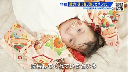 医師に「笑うこともできない」と断言された娘が…　障がいがあっても「七五三」をあきらめない　障がい児に寄り添うカメラマン