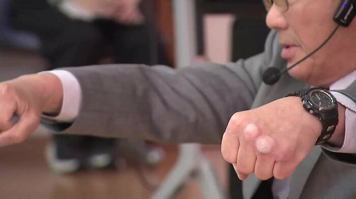 体重を支えて移動するため硬くなった握りこぶし