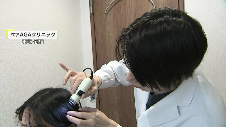 “30年に一度レベル”の少雨で「抜け毛」が増加…医師「乾燥で頭皮乱れ」　対処法は?「シャンプーやり過ぎると頭皮乾燥しやすくなる」｜FNNプライムオンライン