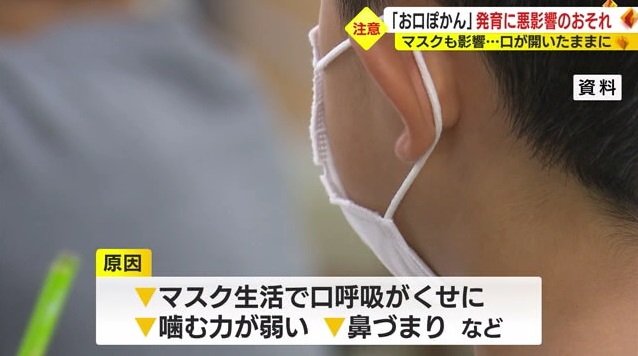 マスク生活も一因に