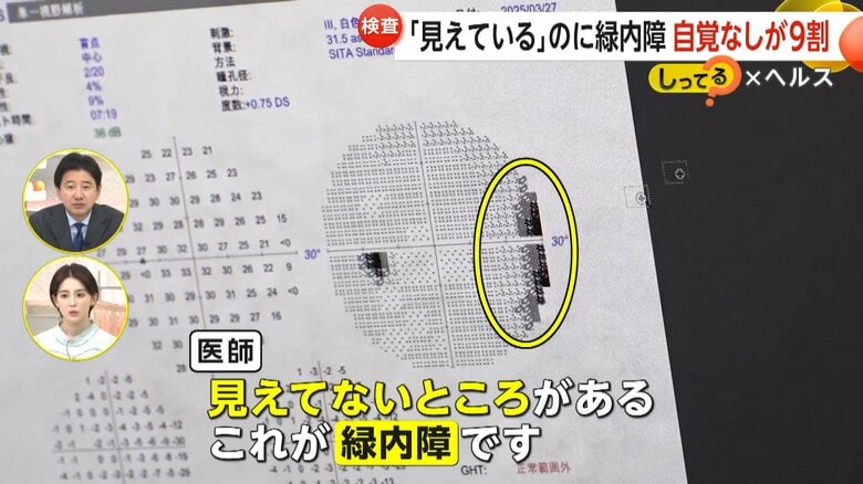 人間ドックで緑内障が疑われやってきた40代の女性の検査結果