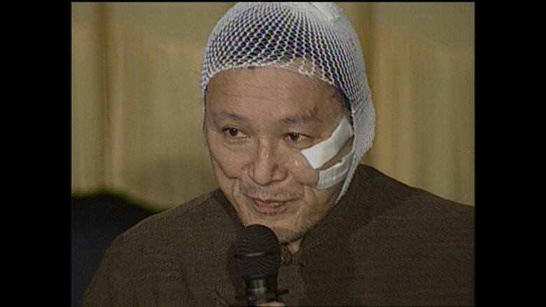 暴力団員の襲撃後に会見した伊丹十三監督