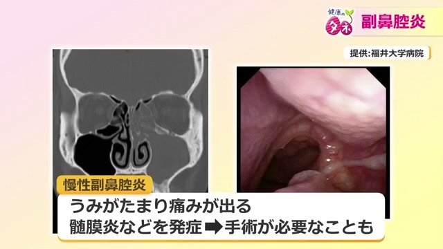 悪化した場合は手術が必要なことも