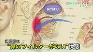 鼻は重要なフィルター！ 花粉症による“口呼吸”は喉に悪影響 睡眠の質が低下し「無呼吸症候群」の恐れも【佐賀発】