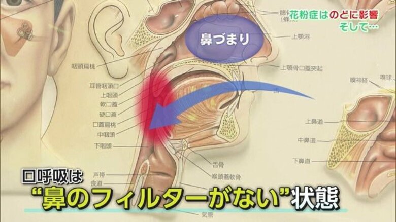 鼻は重要なフィルター！ 花粉症による“口呼吸”は喉に悪影響 睡眠の質が低下し「無呼吸症候群」の恐れも【佐賀発】｜FNNプライムオンライン
