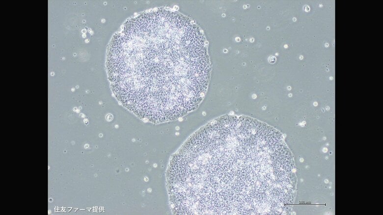 住友ファーマで培養したiPS細胞