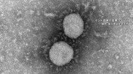 【速報】沖縄で新たに82人感染 4人死亡 「デルタ」も新たに2例