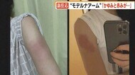 “モデルナアーム” 「かゆみと赤みが…」 全国で報告相次ぐ 対処法は? 福岡市では深夜接種に長い列