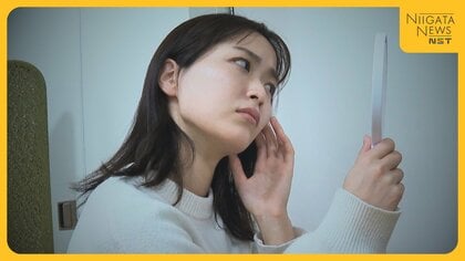 “ニキビ”の低年齢化…原因は生活習慣の変化に？早期治療の重要性・正しい洗顔方法を医師に聞く