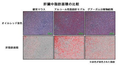 【摂南大学】水溶性食物繊維 ”グアーガム分解物” のアルコール性脂肪肝の改善効果を解明