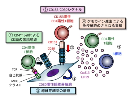 【徳島大学】自己免疫疾患の進行を加速する新メカニズムを解明～免疫細胞と線維芽細胞の“クロストーク”が鍵～