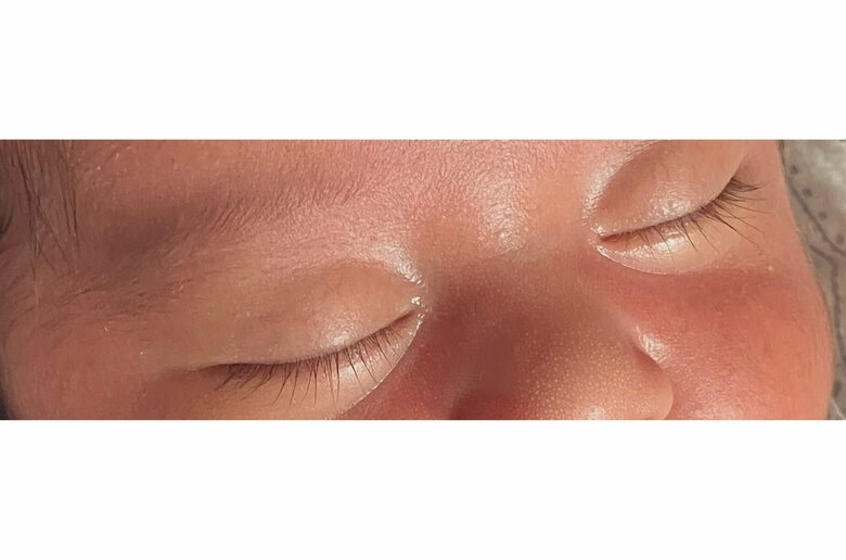 生後2週間目　中央が長く伸びている（提供：ことねさん）