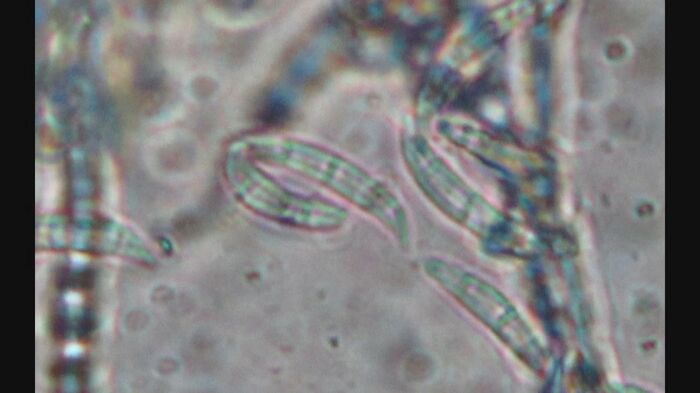 カビ毒「デオキシニバレノール」を産生するカビの一種「フザリウム菌」 提供:食環境衛生研究所