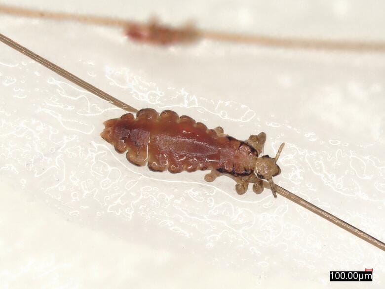 頭部に寄生する「アタマジラミ」の成虫（画像提供：アース製薬）