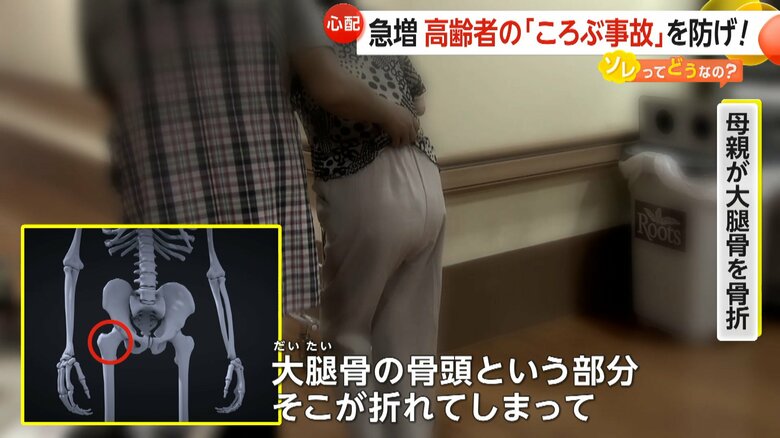 母親が大腿骨の「骨頭」という部分を骨折してしまったという女性
