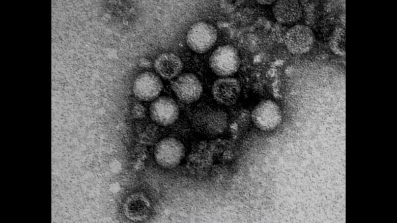 提供：広島市衛生研究所