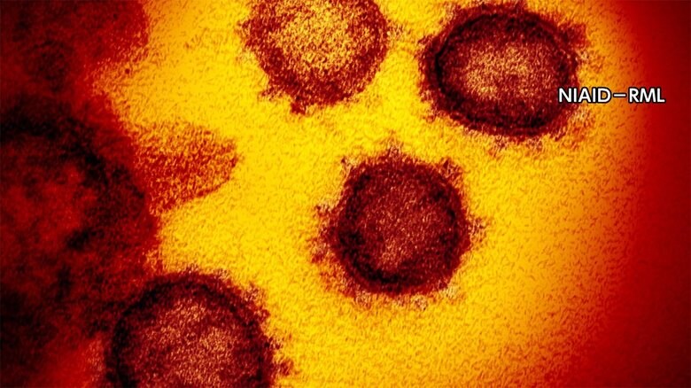 新型コロナ 全国の感染者617人 北海道ツアーで12人感染
