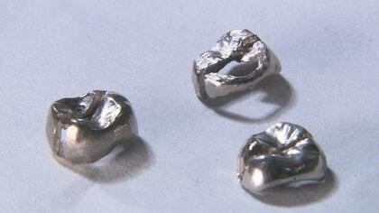 まだ上がる↗そろそろ下がる↘ 貴金属の価格高騰の影響 『儲かる人』の裏に『困る人』の現実【福岡発】