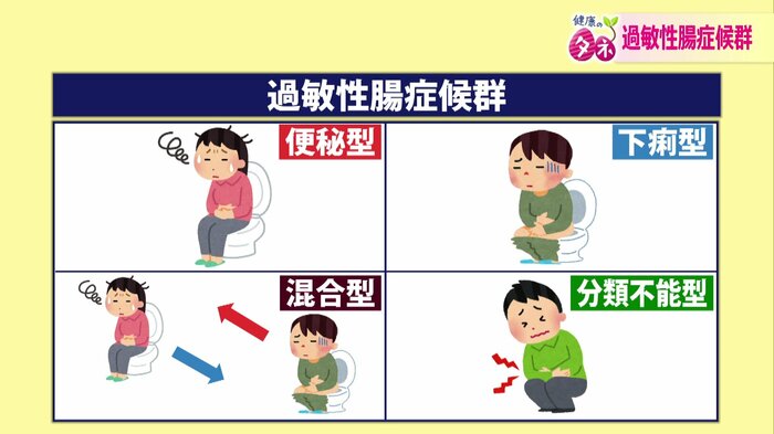 過敏性腸症候群には4つのタイプがある