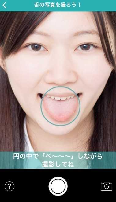 口腔疾患を発見する機能を用いたデモアプリ