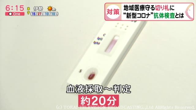 PCR検査より“リスクもコストも低い“…愛知の病院が「抗体検査」開始 院内感染防止の“切り札”