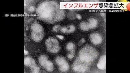 「軽症なのに陽性」猛威を振るうインフルエンザに注意　気づかずに感染拡大のおそれも