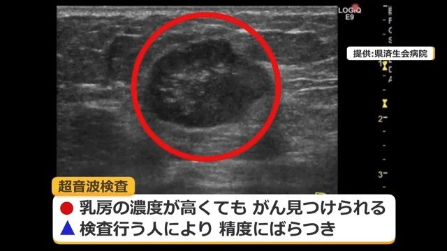 超音波は精度にばらつきも