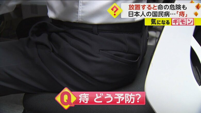 日本人の3人に1人が痔を患っているといわれている