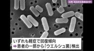 「ウエルシュ菌」で集団食中毒　９７人に下痢や腹痛の症状　広島・福山市の宿泊施設