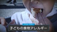 子どもの食物アレルギー“主要三大アレルゲン”小麦から「木の実類」に　予防するには「小さい頃から摂取を」【新潟発】