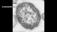 はしか感染者197人…2025年の3倍超、2019年に次ぐ高水準　海外からウイルス…渡航歴ない人にも拡大