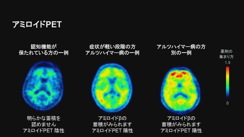 画像提供・福井大学医学部附属病院