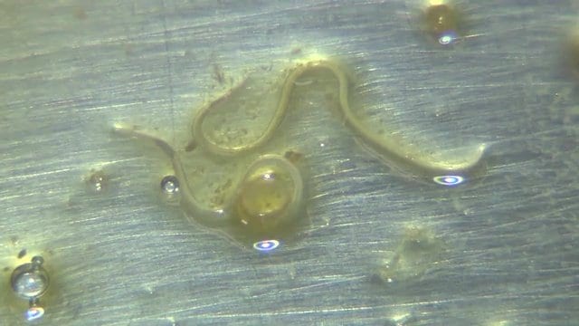アニサキス　東日本の方が毒性が強い