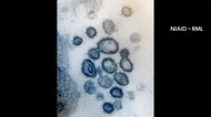 300人以上感染確認 全国各地で集団感染確認