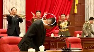 健康異常説が再浮上? 金正恩総書記の後頭部に気になる痕