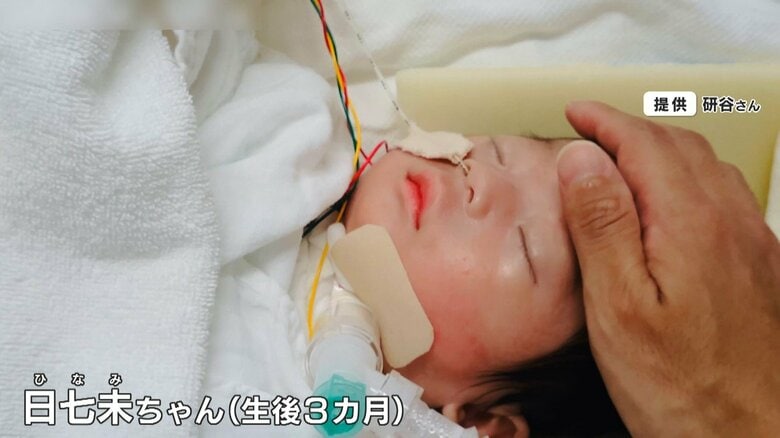 「娘も被害者」交通事故で妊婦死亡・当時胎児だった娘は起訴状に名前なく…脳に重い障害　残された家族が語る思い「こんな未来になるとは」｜FNNプライムオンライン