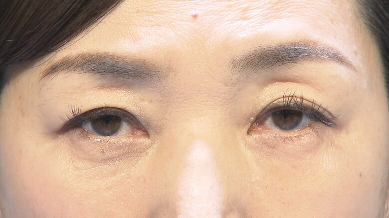 顔の右側（写真右側）に「Second Skin」技術が用いられている