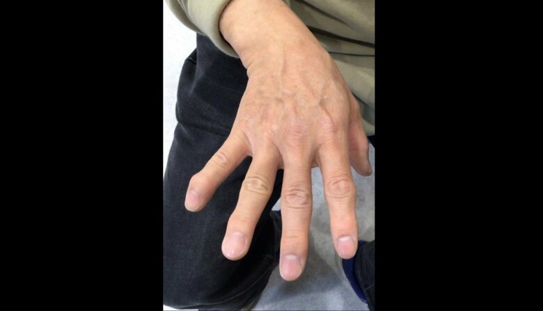 （提供：オクノクリニック銀座）