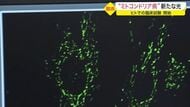「僕はもう勉強ができない」難病“ミトコンドリア病”に苦しむ家族　世界初の治療薬へ臨床試験開始【宮城発】