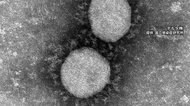 全国で新たに509人感染 東京は8日連続100人下回る 新型コロナウイルス