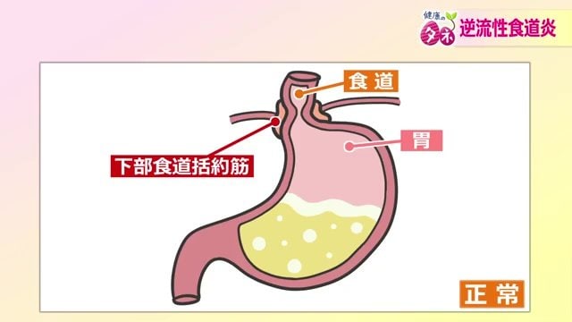 正常な状態