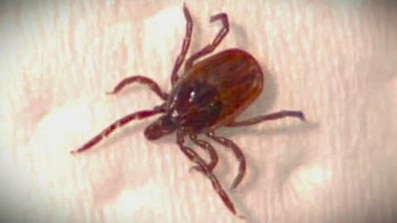 【国内8例目】北海道で「ダニ媒介脳炎」患者発生…20代の男性が発症し治療受ける＿過去には死亡例も…山に入る際は”肌の露出を少なくする”ダニ対策を呼びかけ＜千歳保健所管内＞｜FNNプライムオンライン