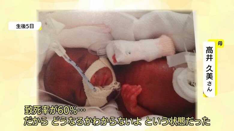 生後5日の結葵ちゃん