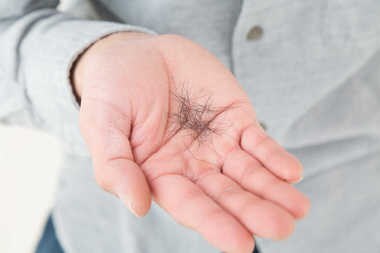 抗がん剤治療に伴う“脱毛”を抑える医療機器が初承認。その仕組みは意外と「目からウロコ」だった