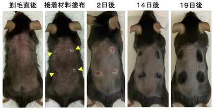 たった一滴塗るだけで完全に毛が生える方法を発見　～新たな発毛治療への応用に期待～
