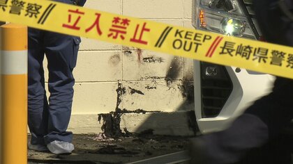 住宅地で人が”火だるま”に　第一発見者「どうしたらいいかわからなかった」  服に火が着く「着衣着火」の対処法