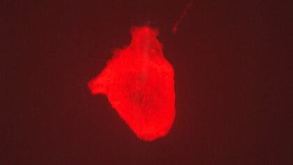 「心臓病では誰も死なせない」万博の目玉『iPS心臓』に挑む医師と科学者　少年の運命を変えた従兄の死