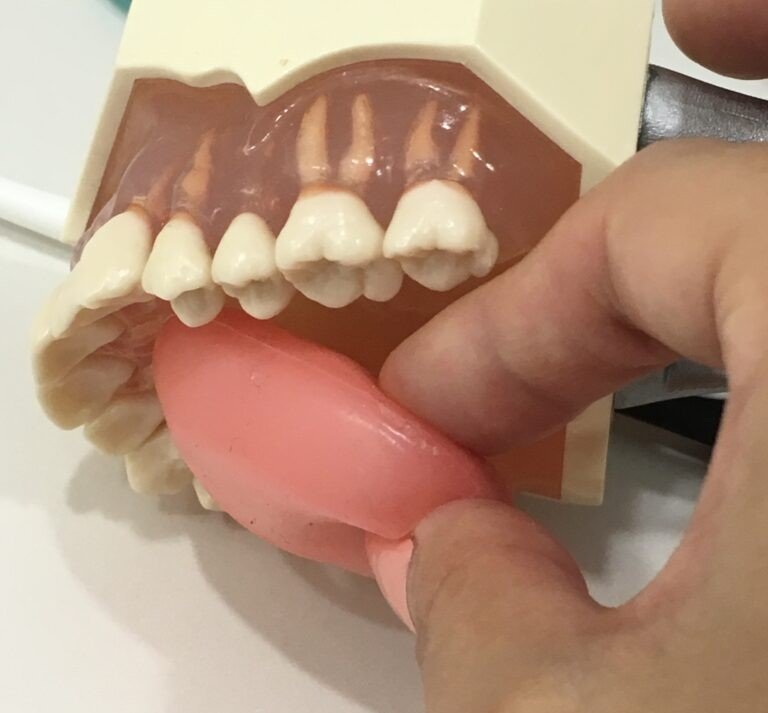 舌のトレーニング（提供：アンチエイジングデンタルクリニック恵比寿）