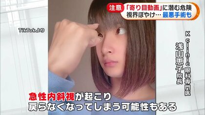 最悪は手術が必要」…TikTokで話題の“寄り目